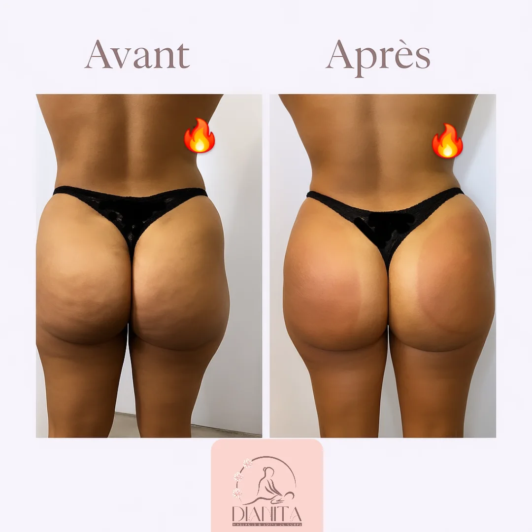 Après - Soins drainants